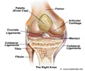 Osteochondritis Dissecans Osteochondritis Dissecans