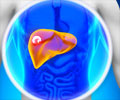 Current Treatments for Liver Cancer