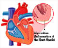 Myocarditis
