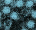 Norovirus