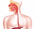 Oesophageal atresia                                                                                                                                                                                     