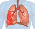Pleurisy - Causes, Symptoms, Diagnosis, Treatment