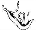 Schistosomiasis - Causes, Symptoms, Diagnosis, Treatment, Prevention
