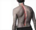 Scoliosis - Facts, Causes, Types, Symptoms & Treatment