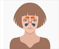 Sinusitis - Types, Causes, Symptoms, Diagnosis, Complications and Treatment Sinusitis - Types, Causes, Symptoms, Diagnosis, Complications and Treatment