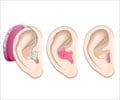 Getting the Right Hearing Aid for Adults Getting the Right Hearing Aid for Adults