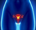 Vulvar Cancer - Symptoms - Diagnosis - Treatment - FAQs