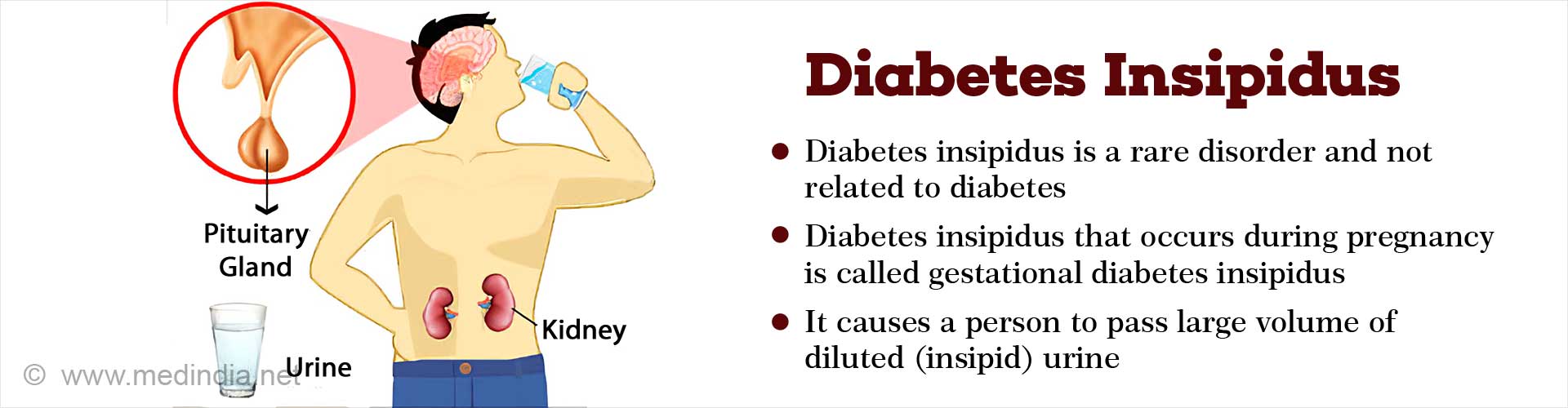 Diabetes Insipidus - Causes, Symptoms, Diagnosis, Treatment, Complications