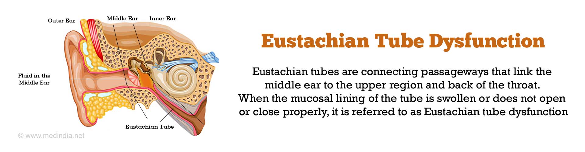 Eustachian Tube Dilation