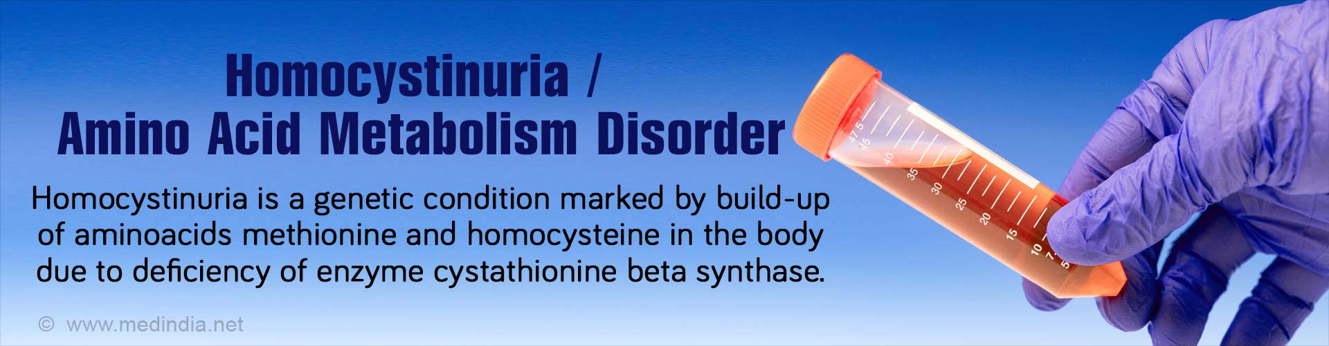 Homocystinuria / Amino Acid Metabolism Disorder