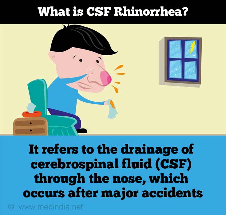 What is CSF Rhinorrhea?