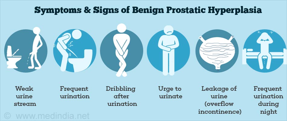 Medical Mnemonics: Bening Prostatic Hypertrophy (BPH) Symptoms Mnemonic