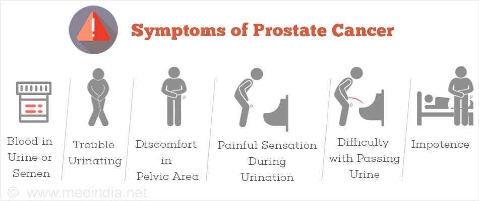 How prostate cancer develops