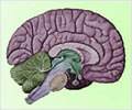 Quiz On Alzheimer’s Disease