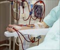 Quiz on Dialysis