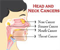 Quiz on Head and Neck Cancer