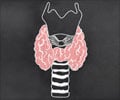 Test Your Knowledge on Hypothyroidism Test Your Knowledge on Hypothyroidism