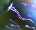 Quiz on Infertility Quiz on Infertility