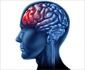Test your Knowledge on Brain Injury Test your Knowledge on Brain Injury