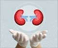 Test Your Knowledge on Kidney Transplantation Test Your Knowledge on Kidney Transplantation