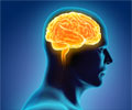 Test Your Knowledge on Intracranial Hypertension Test Your Knowledge on Intracranial Hypertension