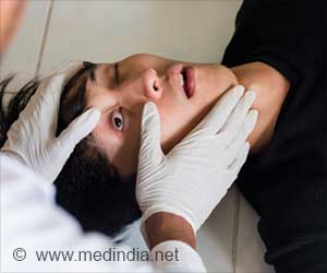 Changes in Body after Death