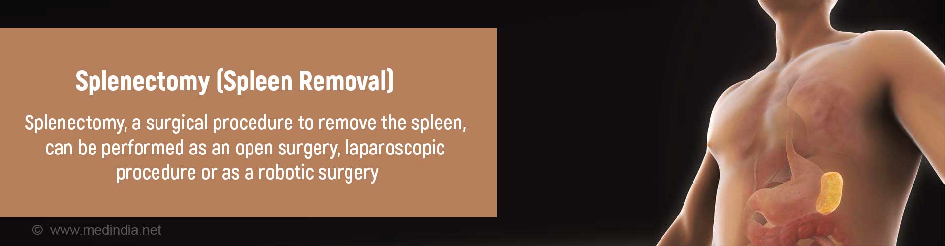 Splenectomy (Spleen Removal)
