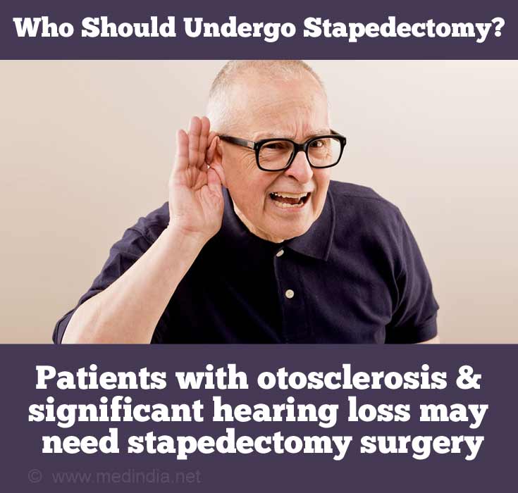 Otosclerosis and Hearing Loss Patients Require Stapedectomy Surgery
