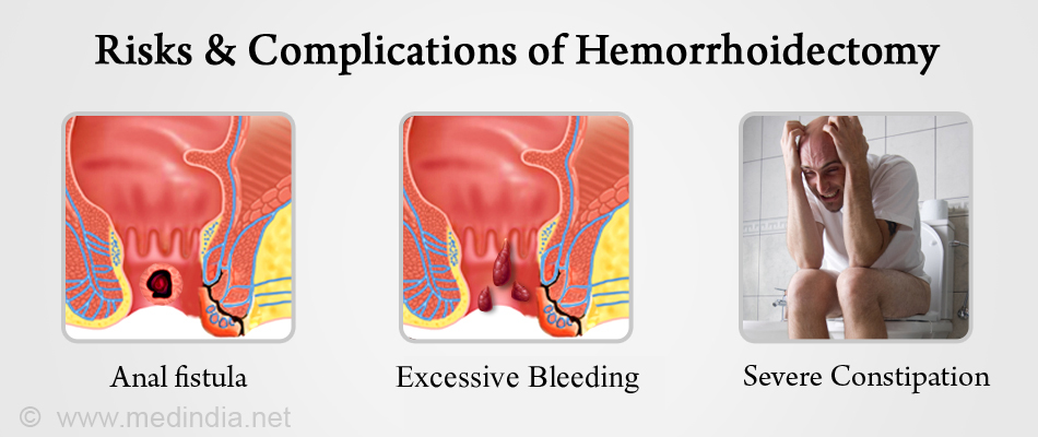 leakage Hemorrhoidectomy complication anal