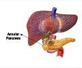 Annular Pancreas / Duodenal Birth Defect