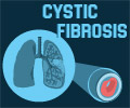 Cystic Fibrosis - Infographics