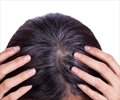 Home Remedies for Gray Hair