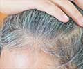 Is Your Hair Turning Gray Early? Here's Why