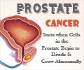 Prostate Cancer - Infographics