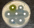 Test your Knowledge on Antibiotic Resistance