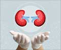 Test Your Knowledge on Kidney Transplantation
