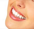 Home Remedies for White Teeth