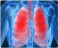 Chronic Obstructive Pulmonary Disease