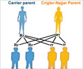 Crigler-Najjar Syndrome - Support Groups
