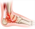 Ankle Pain Symptom Evaluation