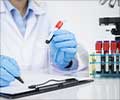 How to Prepare for a Blood Test: Complete Guide