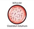 Botulism