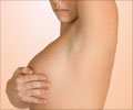 Breast Lumps in Women - Symptom Evaluation