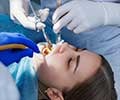 Dental Anesthesia