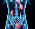 Ectopic Kidney