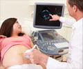 Fetal Heart Ultrasound