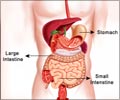 Gastroenteritis