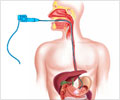 Gastroscopy