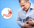 Heartburn Symptom Evaluation
