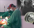 Hip Replacement Surgery